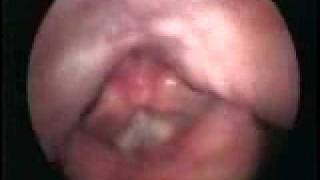 Flexible: female singing at high pitch