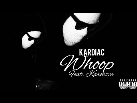 Showcase - Whoop ft. Karmzee (Official Audio)