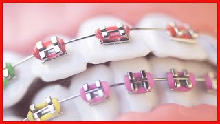 Adultos con dientes de leche: ¿cuándo puede ocurrir