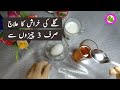 Gale Ki Kharash Ka Ilaj Gale Me Dard Ka Ilaj In Urdu
