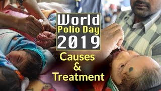 Polio Is Not A Birth Defect, Is Communicable In Hindi