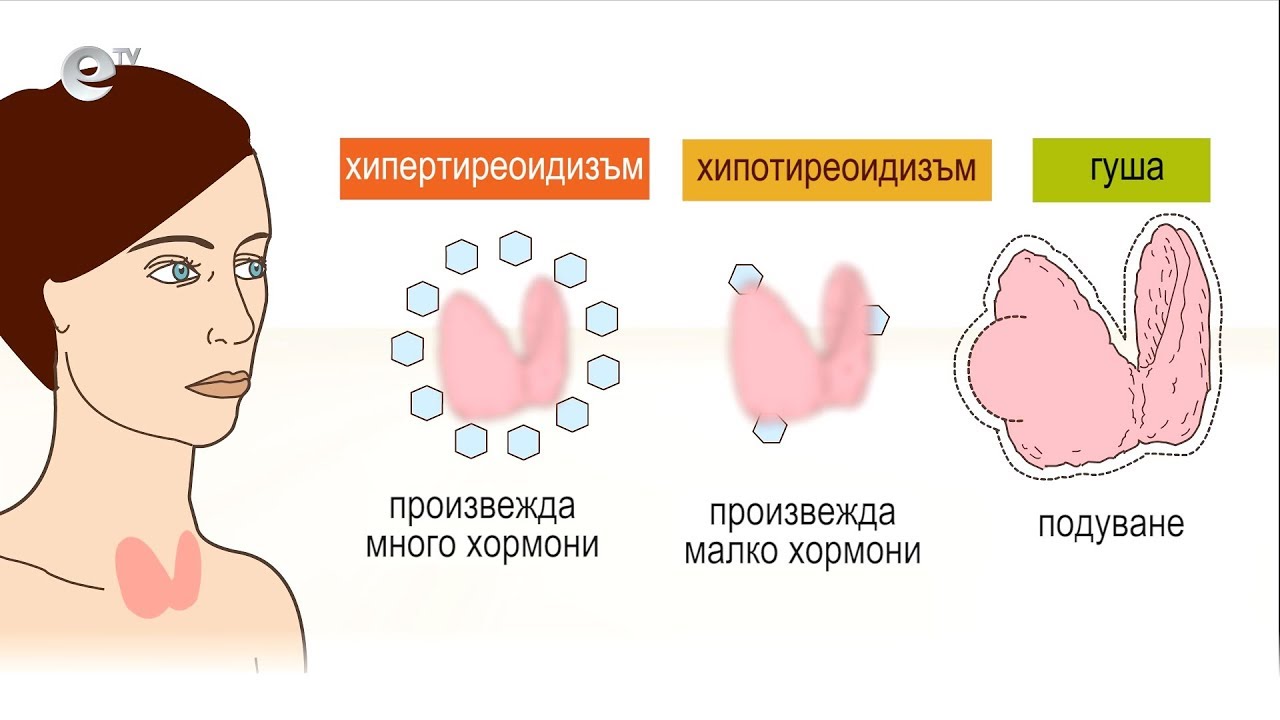 Кандида и Хашимото - бичът на съвременния човек