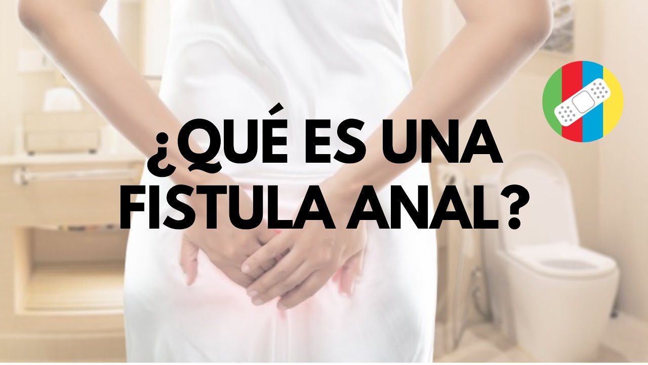 ¿Qué es una fístula y para qué sirve? – LIB Answers
