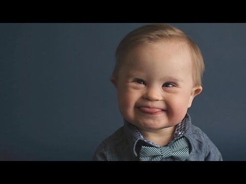 Watch video Mom Shocked Son with Down Syndrome Was Overlooked By Modeling Agency