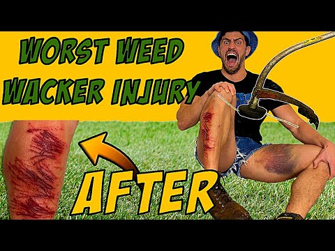Creating the WORST WEED WACKER INJURY of all Time *PURE AGONY* | Bodybuilder VS Weed Eater Test