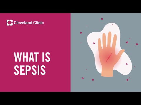 What Is Sepsis?
