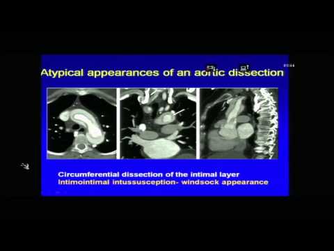 CARDIO RADIOLOGY CME PART 5