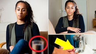 Meet The Girl Who Is Allergic To Water, Even Her Tears Leaves Her In Agony