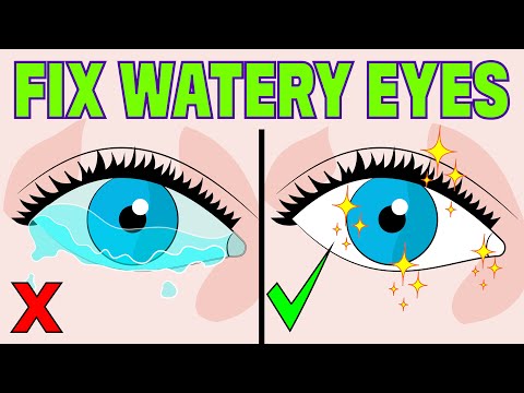 How to Stop Watery Eyes at Home in 3 minutes