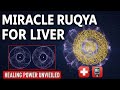 Powerful Ruqya For Healing Diabetes Thyroid Liver Diseases With Surah Yaseen And Surah Fatiha