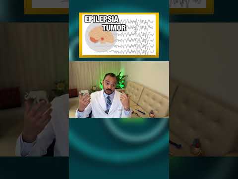 EPILEPSIA NO TUMOR CEREBRAL