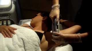 preview picture of video 'IPL Hair Removal | Gold Coast Beauty Salon'