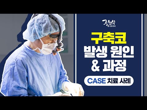 구축코현상 발생 원인과 발생과정 및 케이스별 치료 사례