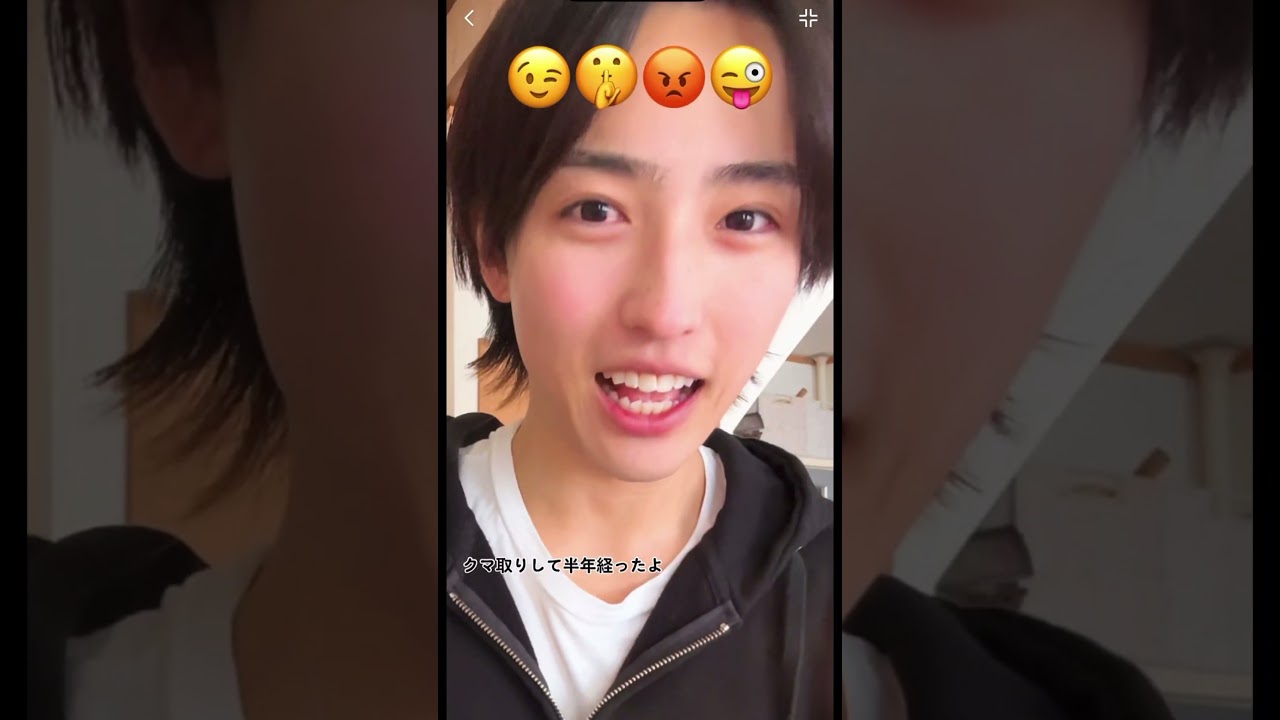 【クマ取り】半年経過したよ〜😳#shorts