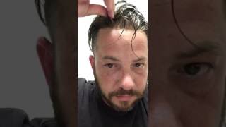 Men's hair system review 3 months- The BAD