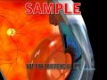 video thumbnail (1)