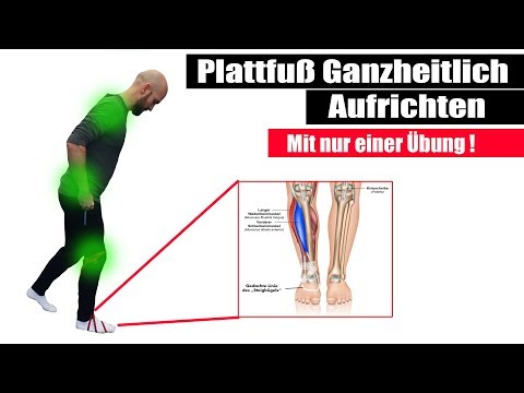 Plattfuß ganzheitlich Aufrichten | Mit nur EINER Übung