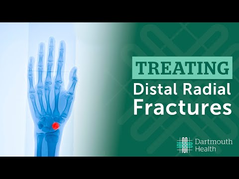 Fracturas del radio distal