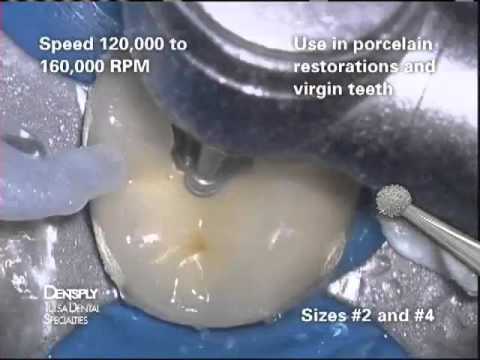 Round Diamond Bur review | Dentsply Sirona