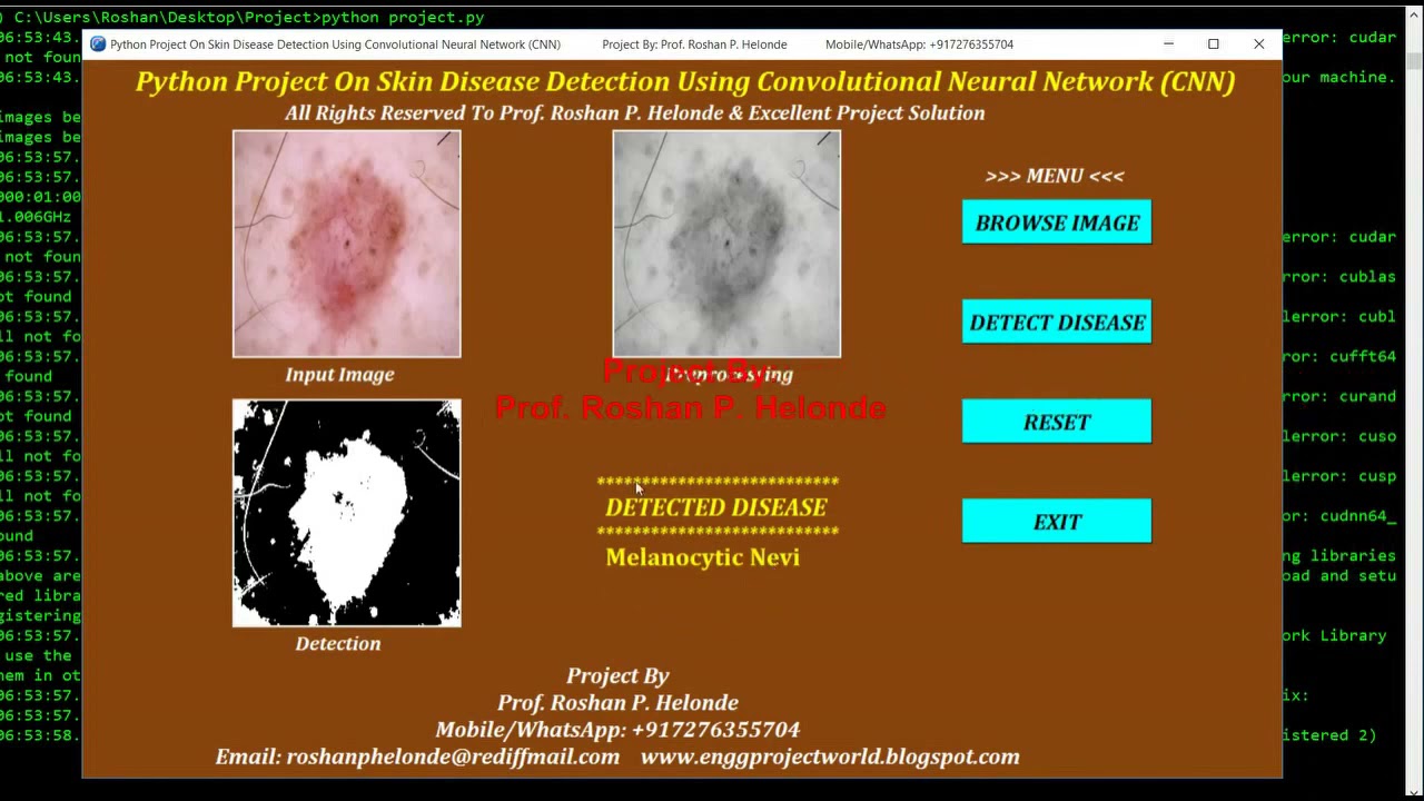 Python Code for Skin Disease Detection Using CNN (Convolutional Neural Network CNN) With Source Code