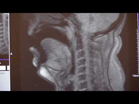 OperaScan - Two Wagner tenors in MRI-scanner - Gruseliges video