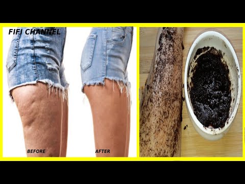 , title : 'How To Get Rid Of Cellulite Naturally  In 3 days|  For Cellulite On Thighs, Stomach & Arms'