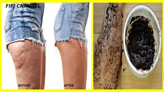How To Get Rid Of Cellulite Naturally  In 3 days|  For Cellulite On Thighs, Stomach & Arms