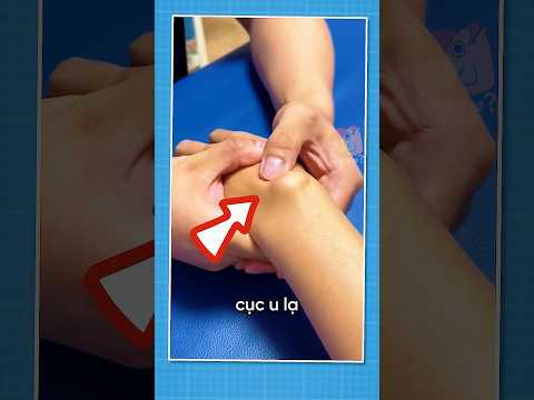 Đừng Bao Giờ Đập Cục U Này! 😱