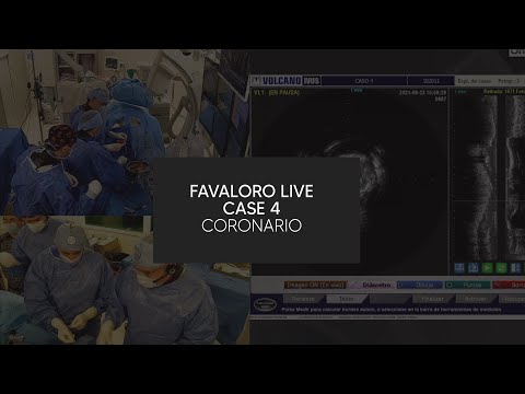 Favaloro Live Case N° 4 - Coronario (México)