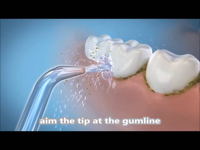 Vidéo teaser pour How to use Waterpik WP-861E Complete Care 5.0