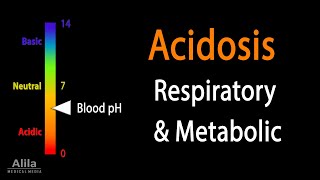 Acidosis, Respiratory and Metabolic