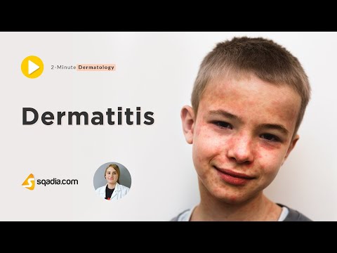 nyelőcsőrák kapcsolódik a hpv-hez galandféreg sügér