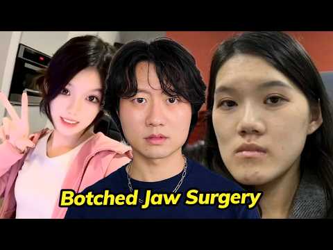 Funsizedasian Of