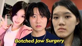 Chinese Model Goes Viral After Plastic Surgery