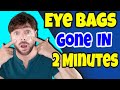 REMOVE Under Eye Bags In 2 MINUTES Or Less | Chris Gibson #shorts