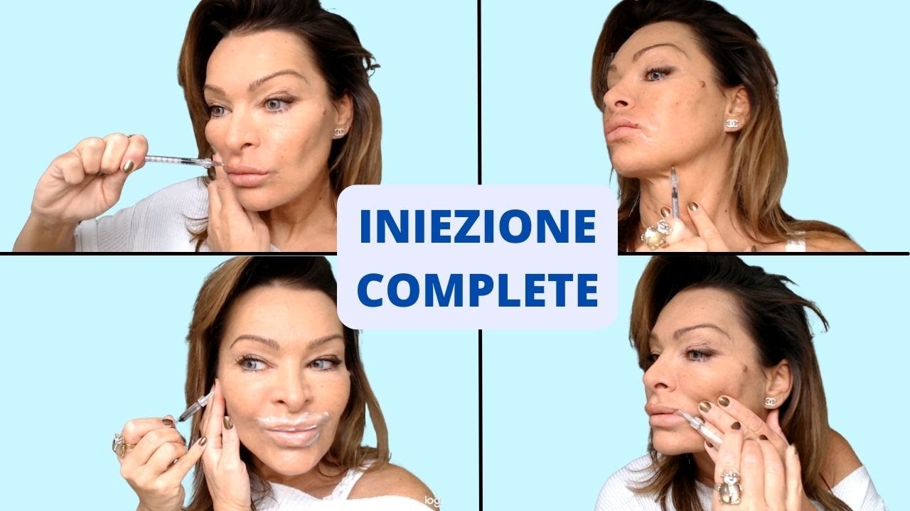 INIEZIONI COMPLETE ! ZIGOMO, BOCCA, VISO OVALE, MASCELLA, COLLO E  DECOLLETE !