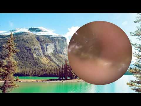 DRY SKIN & EAR WAX REMOVAL | Ear wax for the first time