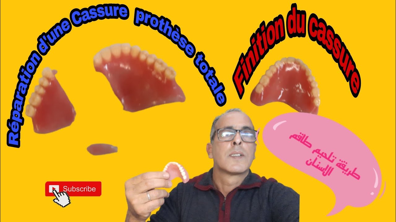 Réparation d'une cassure d'une prothèse dentaire totale. طريقة تلحيم طاقم الاسنان