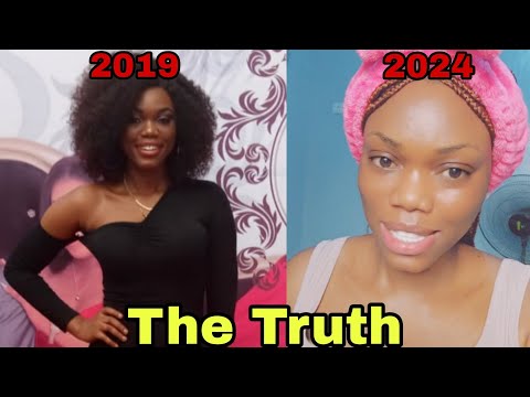 Why I Bleached My Skin... I Was Called Out On Tiktok