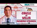 Circulatory System Circle Of Willis Ischemic Strokes