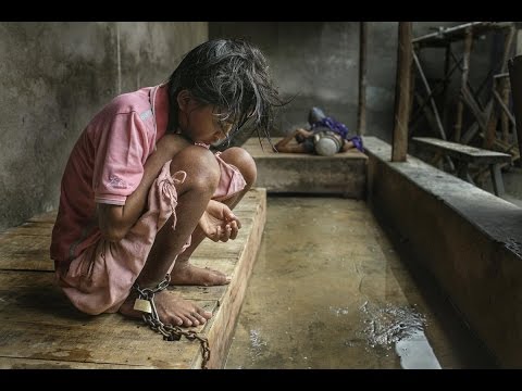 INDO365 - HEALTH - Treating Mental Health With Shackles