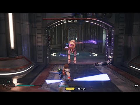 STAR WARS Jedi: Survivor: D-L1T Boss Fight