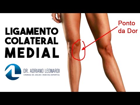 Medial Collateral Ligament Injury: Symptoms, Diagnosis, and Treatment