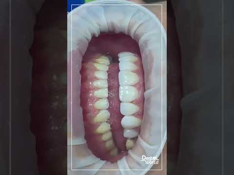 video CangqOazaWk