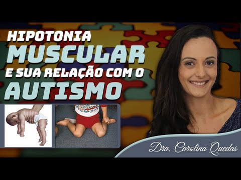 Muscle Hypotonia and Autism Spectrum Disorder