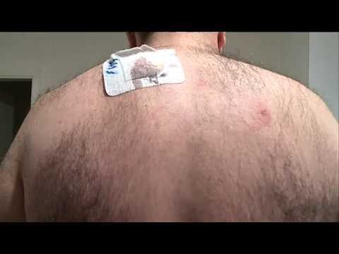 Rahim NAMAZOV, victime d'un guet-apens à Colomiers, se sent toujours menacé de mort