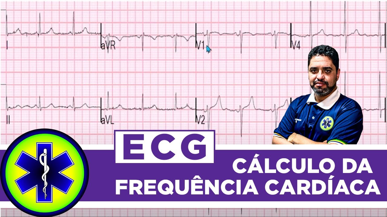 Como calcular a frequência cardíaca pelo traçado do eletrocardiograma (ECG)