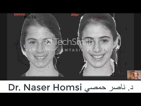 Melhor Palestra d Odontologia para Faculdade para Estudantes Odontologia e Dentistas Dr. Naser Homsi