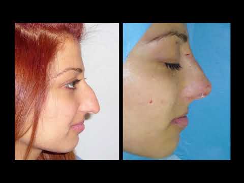Maschera per pelle flaccida un secolo Viaggio di bon agiotage il pacco di faccia schiarente