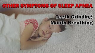 What are the signs of sleep apnea in children?